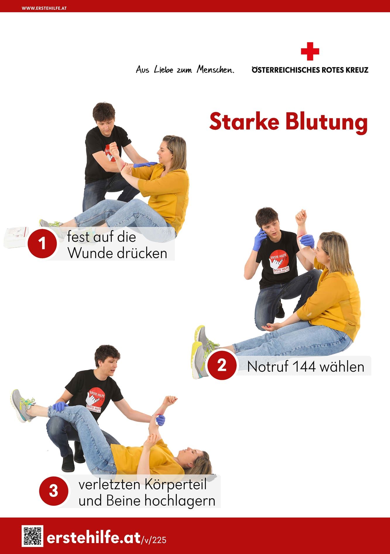 Starke Blutung: 1. fest auf die Wunde drücken, 2. Notruf 144 wählen, 3. verletzten Körperteil und Beine hochlagern